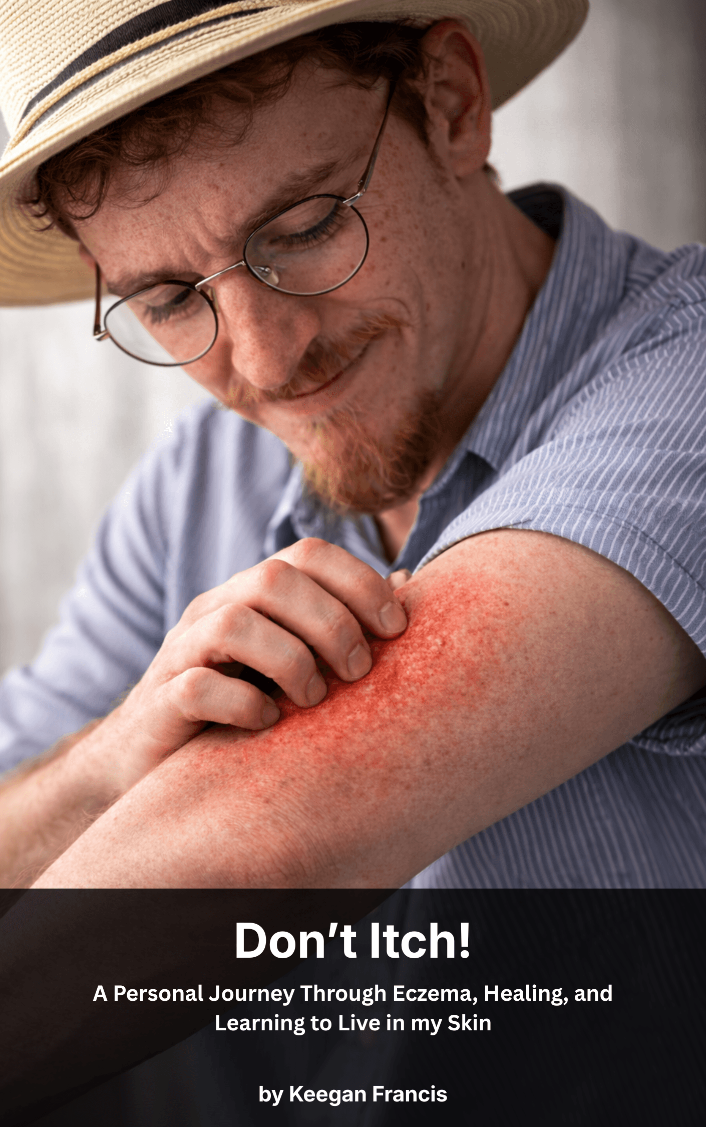 Don't Itch! - A Personal Journey Through Eczema, Healing, and Learning to Live in my Skin by Keegan Francis